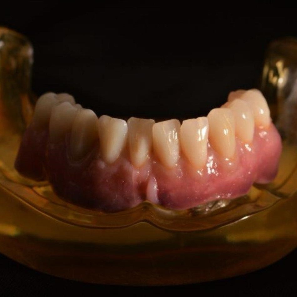Pete Livesey close-up of amazing denture at Skipton Road Dental Practice in . Expert denture care in , Lancashire.